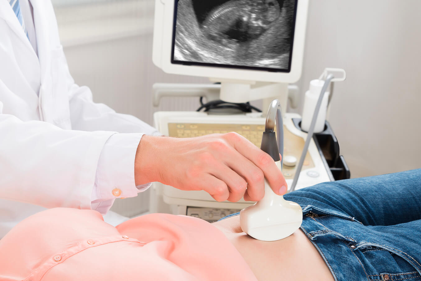 Non-Invasive Prenatal Test (NIPT)