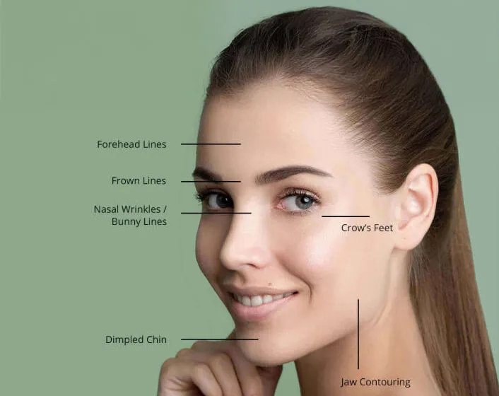 Diagram of a woman's face labeling facial treatment areas