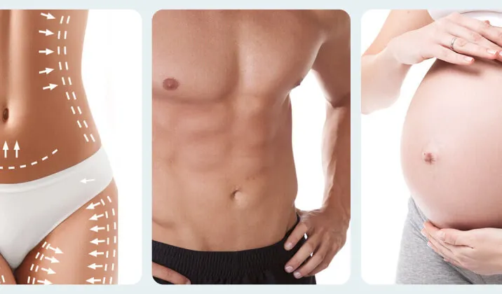 Three-panel image showing body contouring markings on a woman's torso, a fit male torso, and a pregnant woman holding her stomach