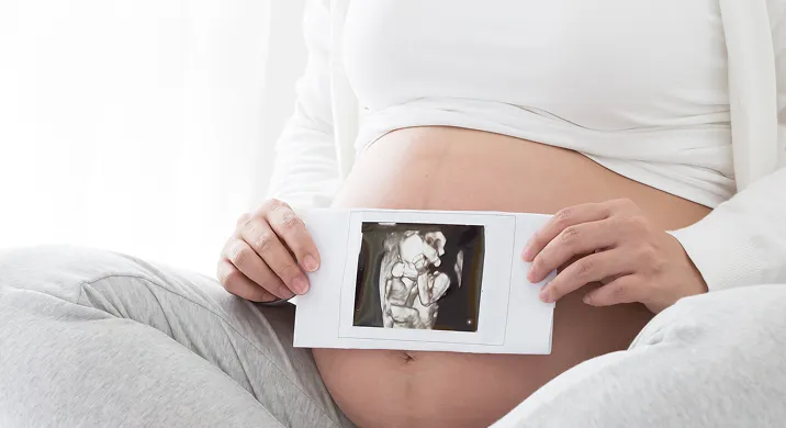 A pregnant woman sitting down and holding an ultrasound photo representing  Obstetric Services.