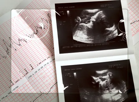 Fetal ultrasound photos and an EKG chart on a table at a pregnancy clinic.